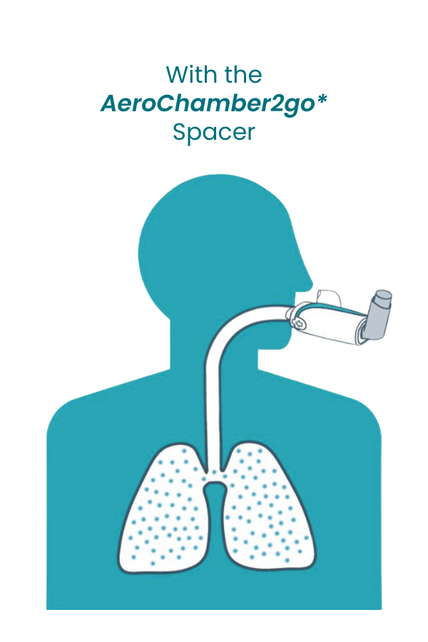 With the AeroChamber2go spacer: more medication reaching the lungs